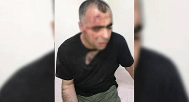 AKP’li başkanın korumalarından usulsüzlüğü duyuran gazeteciye saldırı 